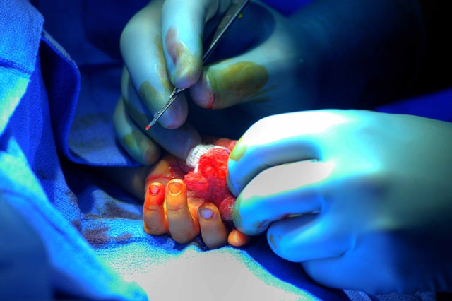 Close-up of hands in blue surgical gloves handling what appears to be medical material or tissue with blue lighting.